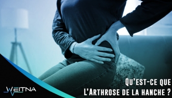 Qu'est-ce que l'arthrose de la hanche ?
